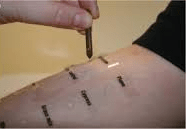 Allergy-assessment