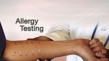Allergy-testing