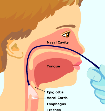 Laryngopharyngoscopy