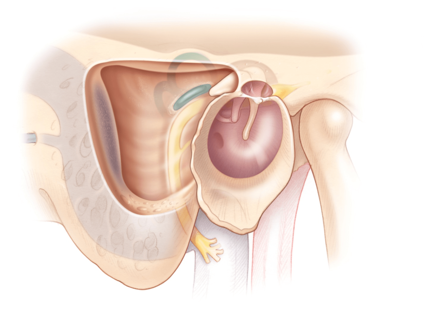 Mastoidectomy