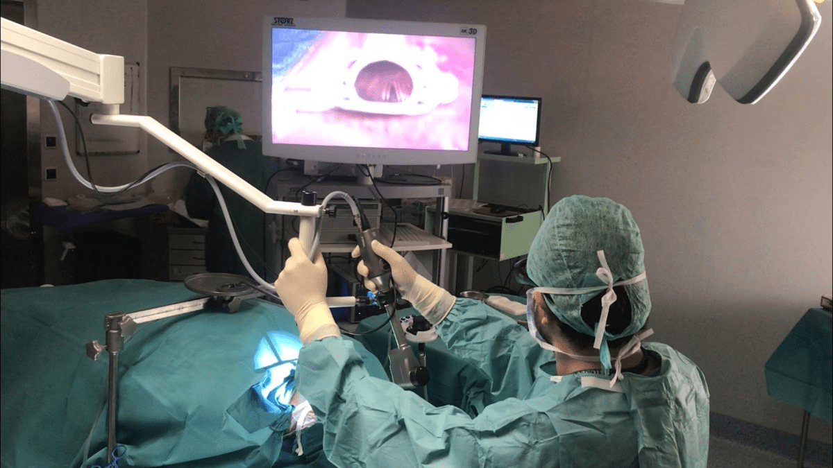 Microlaryngeal-surgery