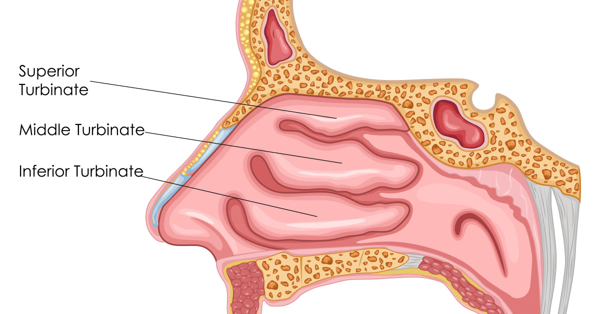 Turbinoplasty